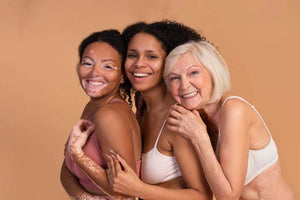 Embracing Imperfections: Celebrate Your Unique Beauty